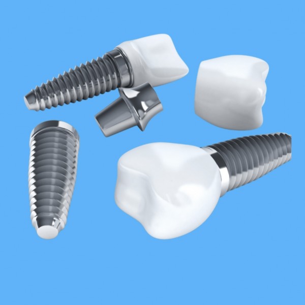 implant Tedavisi 1