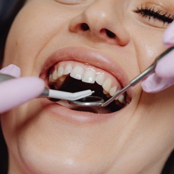 Restoratif Diş Tedaviler